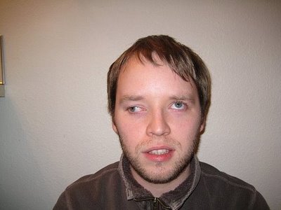 Lazy-Eye-1.jpg